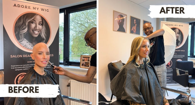 Mois de sensibilisation à la perte de cheveux x Natalie
