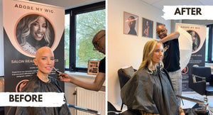Hair Loss Awareness Month x Natalie