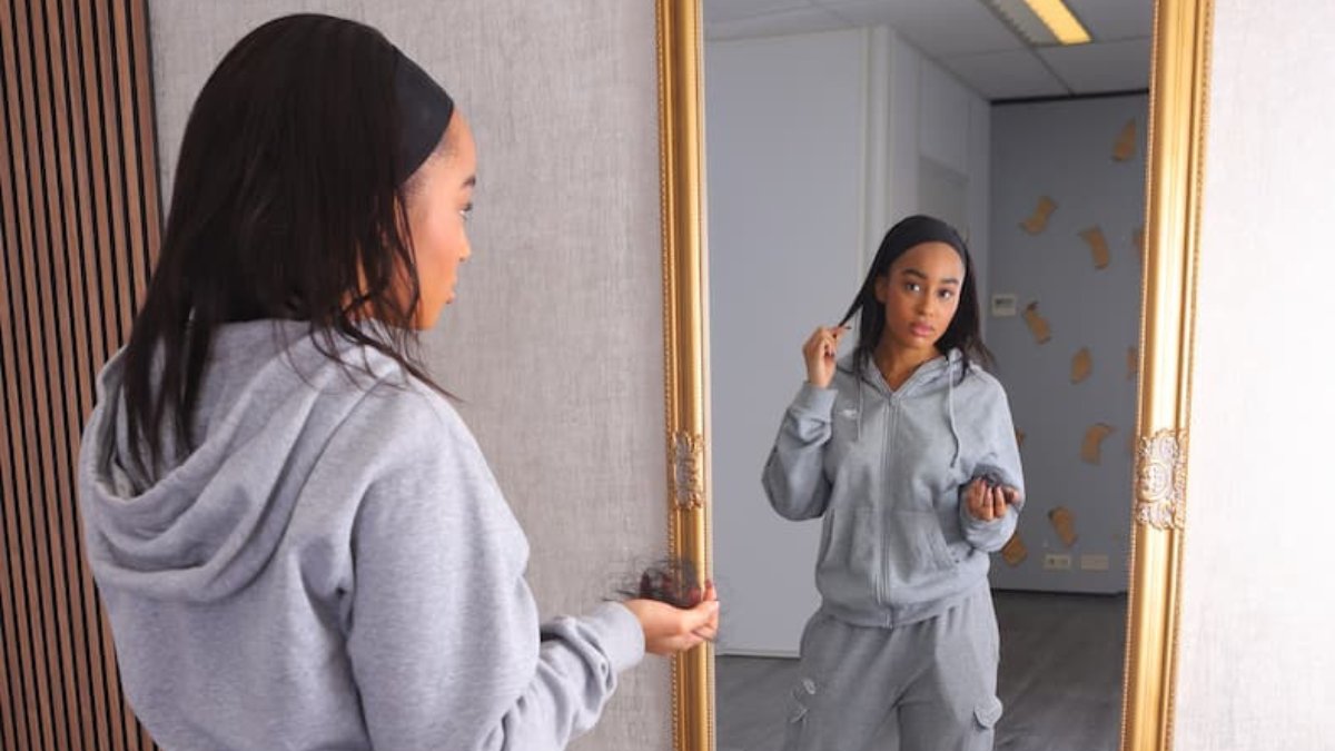 Haaruitval na een Gastric Bypass