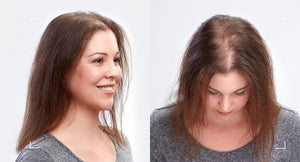 Adore My Wig helps with hair loss Alopecia