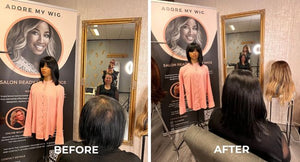 Hair loss after an unknown self-attacking disease