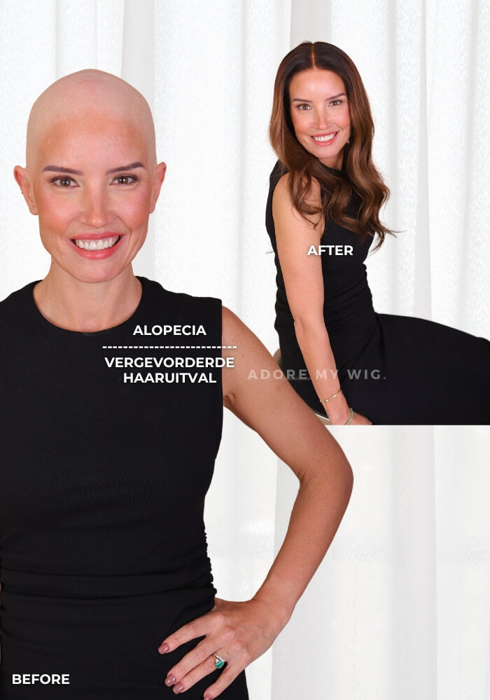 Ambición: Diseño de Peluca de Cabello Humano GlamLace HD Personaliza la Tuya